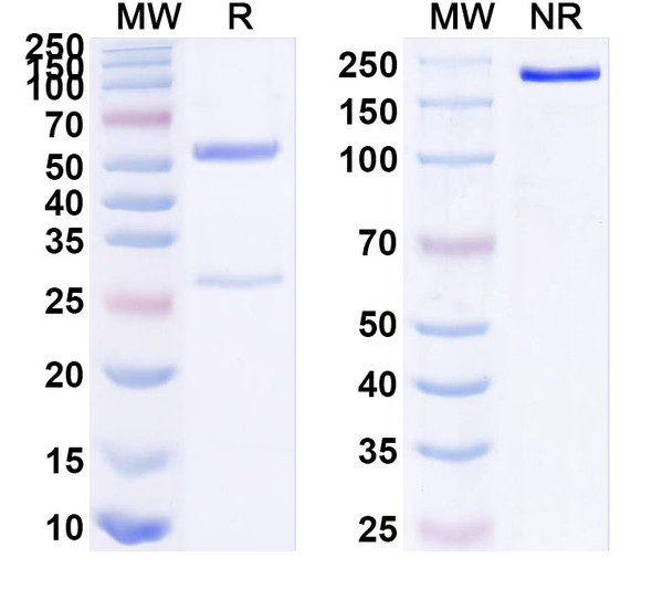 Anti-Human SSTR2/SRIF-1 Recombinant Monoclonal Antibody (18087) - SDS-PAGE