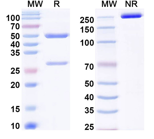 Anti-Human CDH3/P-cadherin Recombinant Monoclonal Antibody (PPAT-057-17) - SDS-PAGE