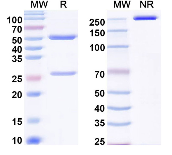 Anti-Human POSTN/OSF-2 Recombinant Monoclonal Antibody (LG2) - SDS-PAGE