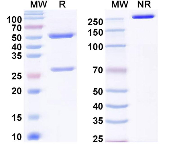Anti-EBV/HHV-4 LMP1/BNLF1 Recombinant Monoclonal Antibody (H11F6) - SDS-PAGE