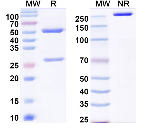 Anti-EBV/HHV-4 LMP1/BNLF1 Recombinant Monoclonal Antibody (B2A4) - SDS-PAGE