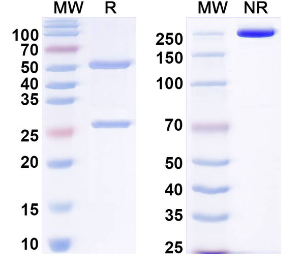 Anti-EBV/HHV-4 LMP1/BNLF1 Recombinant Monoclonal Antibody (B8) - SDS-PAGE