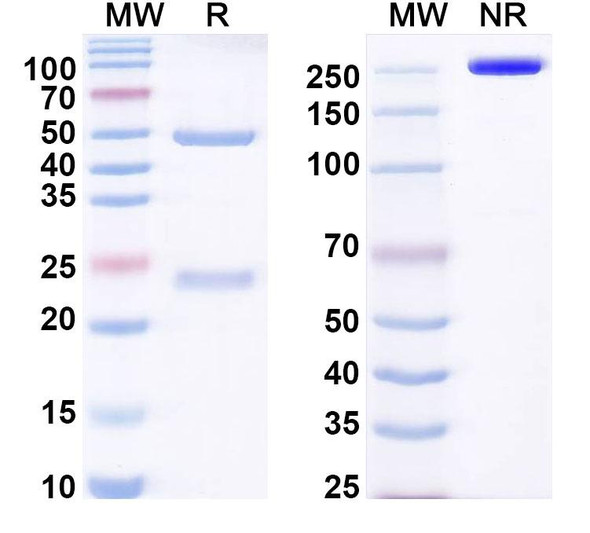 Anti-EBV/HHV-4 LMP1/BNLF1 Recombinant Monoclonal Antibody (E2) - SDS-PAGE
