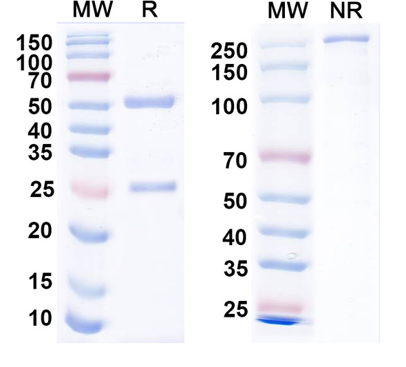 Anti-EBV/HHV-4 gH/BXLF2 Recombinant Monoclonal Antibody (CL40) - SDS-PAGE
