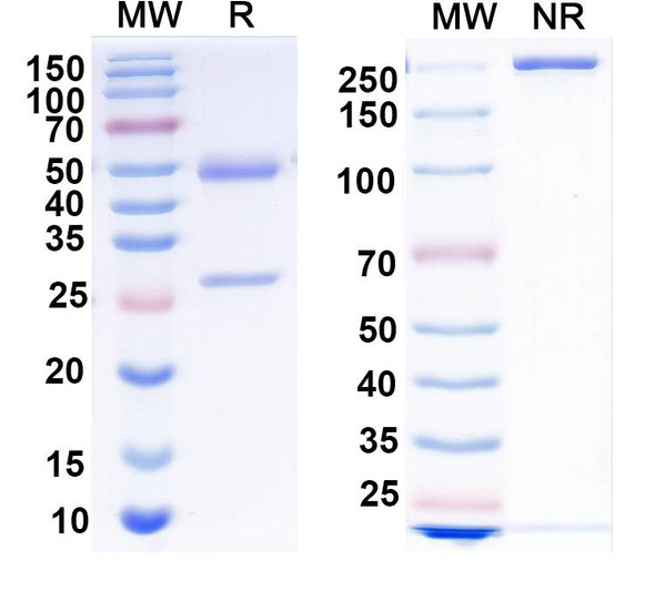Anti-EBV/HHV-4 gH/BXLF2 Recombinant Monoclonal Antibody (CL59) - SDS-PAGE