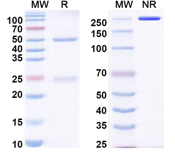 Anti-Human TIMP2 Recombinant Monoclonal Antibody (SAA0317) - SDS-PAGE