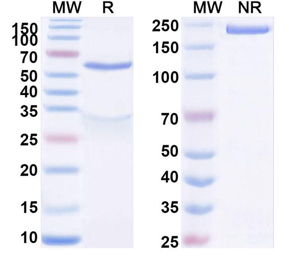 Anti-Human GRIN1/NMDAR1 Recombinant Monoclonal Antibody (A4B2/Glunomab) - SDS-PAGE