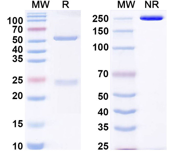 Anti-HHV-5/HCMV gB/Envelope glycoprotein B Recombinant Monoclonal Antibody (F3c10) - SDS-PAGE