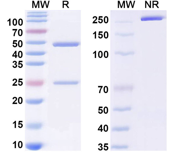 Anti-Ganglioside GM1 Recombinant Monoclonal Antibody (F6) - SDS-PAGE