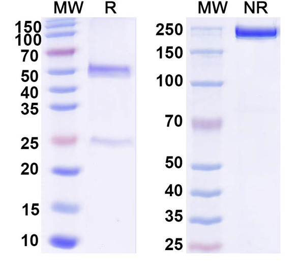 Anti-Ganglioside GD2 Recombinant Monoclonal Antibody (SAA0322) - SDS-PAGE