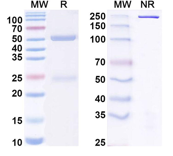 Anti-Human Gal-1/LGALS1 Recombinant Monoclonal Antibody (8A12) - SDS-PAGE