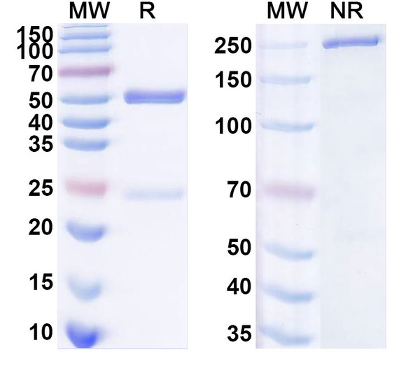 Anti-Rat GRIA2/GluR-2 Recombinant Monoclonal Antibody (15F1) - SDS-PAGE