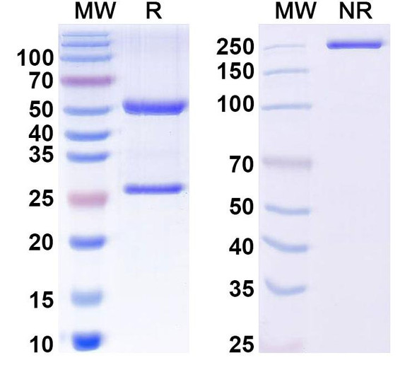 Anti-Mouse GluA1/GluR1 Recombinant Monoclonal Antibody (N355/1R) - SDS-PAGE