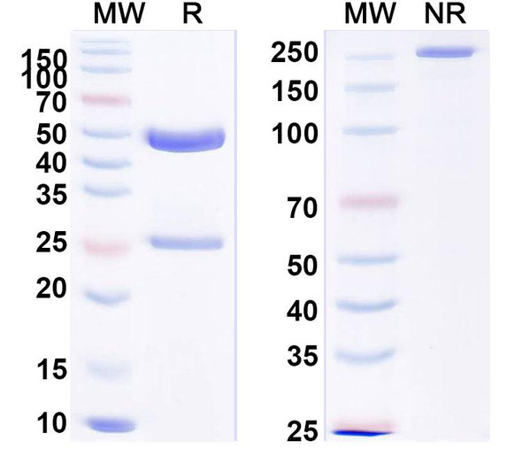 Anti-Human FGB/Fibrinogen beta Recombinant Monoclonal Antibody (8E5#) - SDS-PAGE