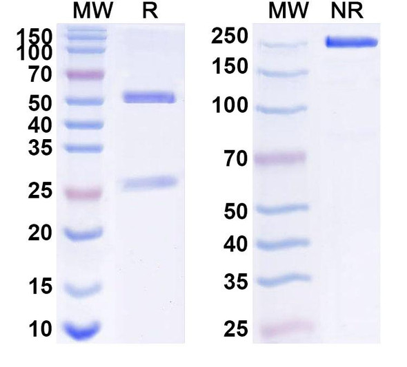 Anti-Human B2M/Beta-2-microglobulin Recombinant Monoclonal Antibody (BBM.1) - SDS-PAGE