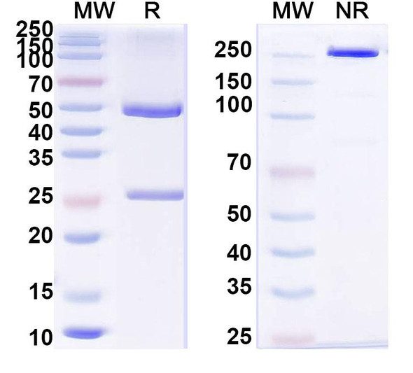 Anti-Human HGF Recombinant Monoclonal Antibody (SFN68) - SDS-PAGE