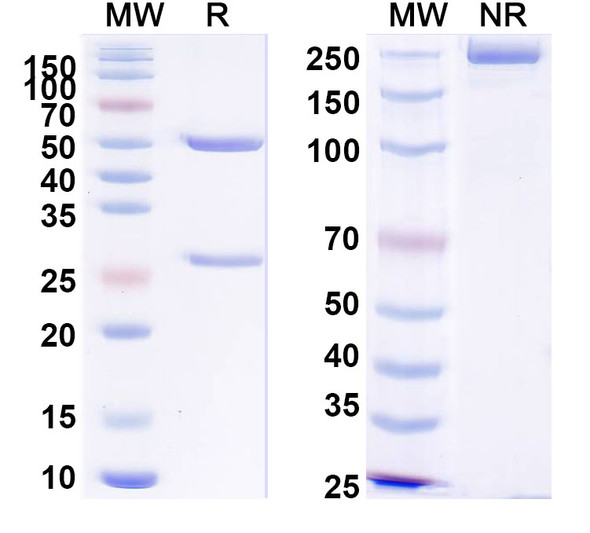 Anti-Human APOE Recombinant Monoclonal Antibody (SAA0799) - SDS-PAGE