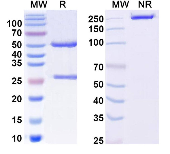 Anti-Vaccinia virus/VACV A27L Recombinant Monoclonal Antibody (186#) - SDS-PAGE