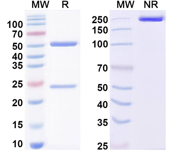 Anti-FMDV Capsid protein VP1 Recombinant Monoclonal Antibody (1E12#) - SDS-PAGE