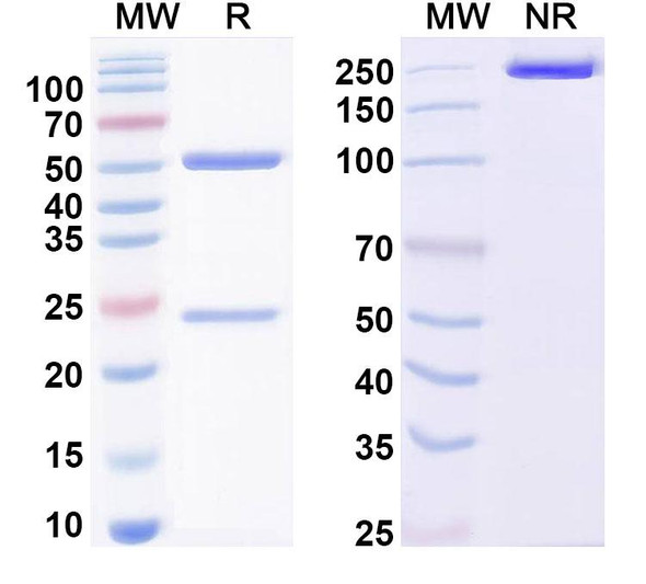 Anti-FMDV Capsid protein VP1 Recombinant Monoclonal Antibody (1E12#) - SDS-PAGE