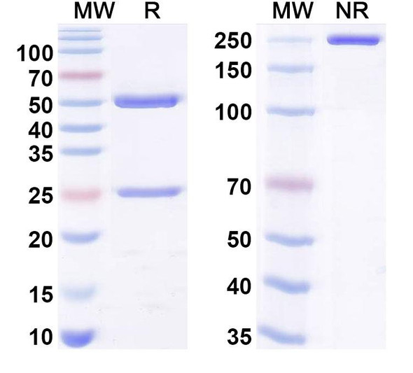 Anti-Dermatophagoides pteronyssinus DERP7/DERPVII Recombinant Monoclonal Antibody (WH9) - SDS-PAGE