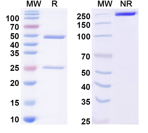 Anti-Dermatophagoides pteronyssinus DERP1 Recombinant Monoclonal Antibody (1C14) - SDS-PAGE
