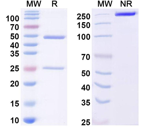 Anti-Dermatophagoides pteronyssinus DERP2/DERPII Recombinant Monoclonal Antibody (7A1) - SDS-PAGE