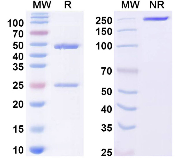 Anti-Human MMP7 Recombinant Monoclonal Antibody (SAA0353) - SDS-PAGE
