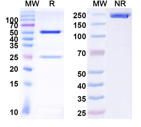 Anti-Coxsackievirus A16/CVA16 Capsid protein/Genome polyprotein Recombinant Monoclonal Antibody (SAA0355) - SDS-PAGE