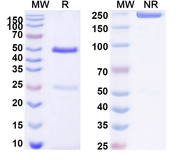 Anti-Human CXADR Recombinant Monoclonal Antibody (SAA0357) - SDS-PAGE