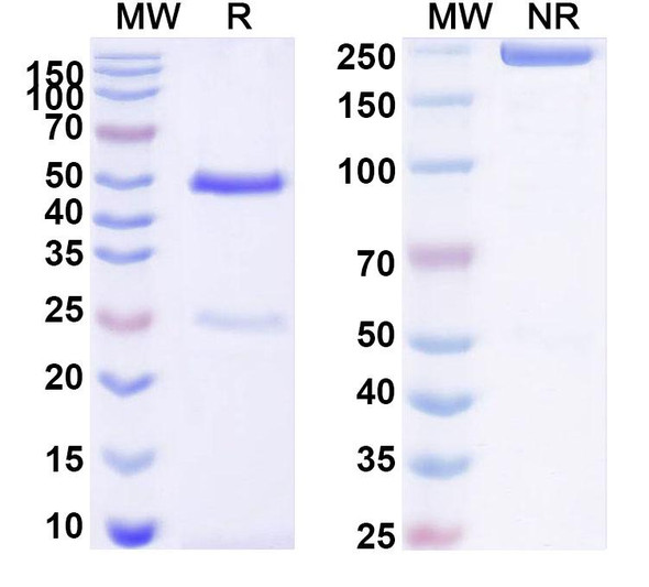 Anti-Human CXADR Recombinant Monoclonal Antibody (SAA0357) - SDS-PAGE