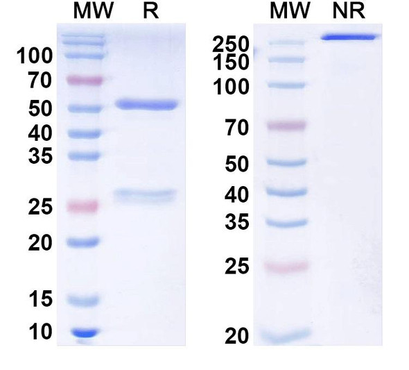 Anti-AAV2 VP1/Capsid protein VP1 Recombinant Monoclonal Antibody (SAA0362) - SDS-PAGE