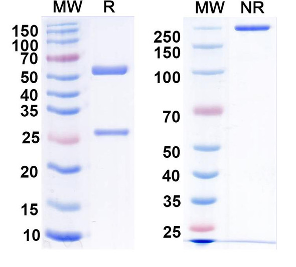 Anti-RABV G/Glycoprotein Recombinant Monoclonal Antibody (SO57) - SDS-PAGE