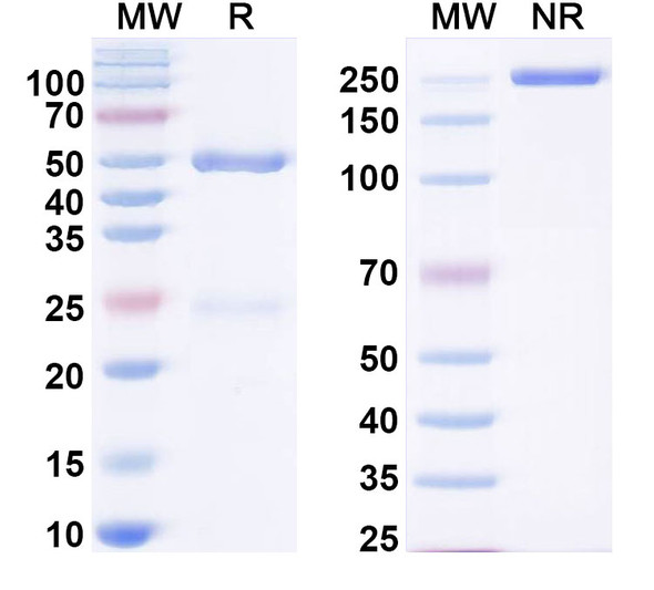 Anti-Mouse/Rat ADAM22 Recombinant Monoclonal Antibody (SAA0491) - SDS-PAGE