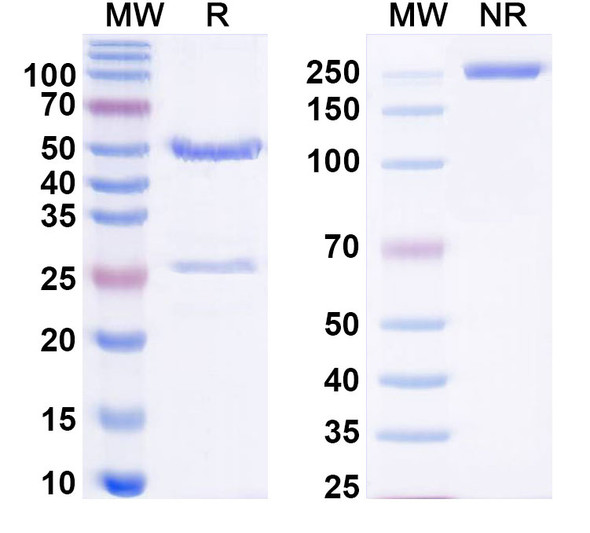 Anti-Human ADAM15/MDC15 Recombinant Monoclonal Antibody (SAA0494) - SDS-PAGE