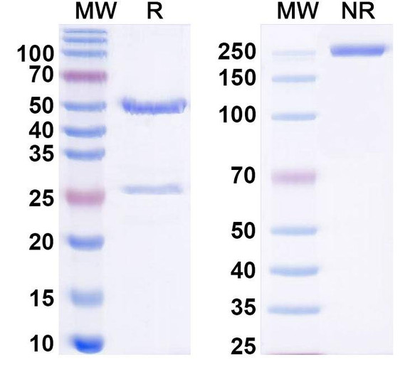 Anti-Human BCHE/CHE1 Recombinant Monoclonal Antibody (SAA0495) - SDS-PAGE