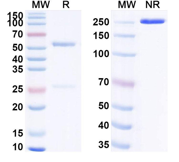 Anti-Human HCN3 Recombinant Monoclonal Antibody (SAA0501) - SDS-PAGE