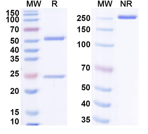 Anti-Human HRAS Recombinant Monoclonal Antibody (SAA0505) - SDS-PAGE