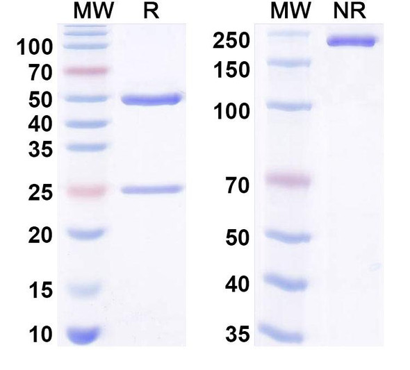 Anti-Hg2+/Mercury(2+) Recombinant Monoclonal Antibody (SAA0525) - SDS-PAGE