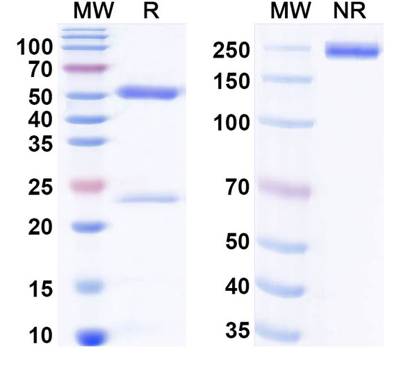 Anti-Human NPY Recombinant Monoclonal Antibody (SAA0521) - SDS-PAGE