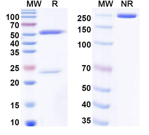 Anti-Human TNN/Tenascin-N Recombinant Monoclonal Antibody (SAA0517) - SDS-PAGE