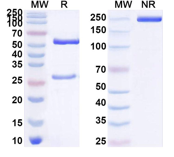 Anti-Human GLP1R Recombinant Monoclonal Antibody (SAA0519) - SDS-PAGE