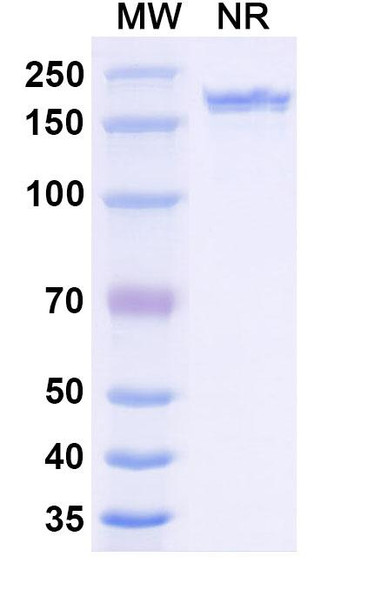 Anti-Human VEGFA Recombinant Monoclonal Antibody (SAA0531) - SDS-PAGE