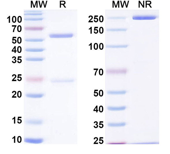 Anti-Human LCAT Recombinant Monoclonal Antibody (SAA0536) - SDS-PAGE