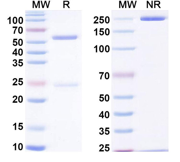 Anti-Human LCAT Recombinant Monoclonal Antibody (SAA0536) - SDS-PAGE