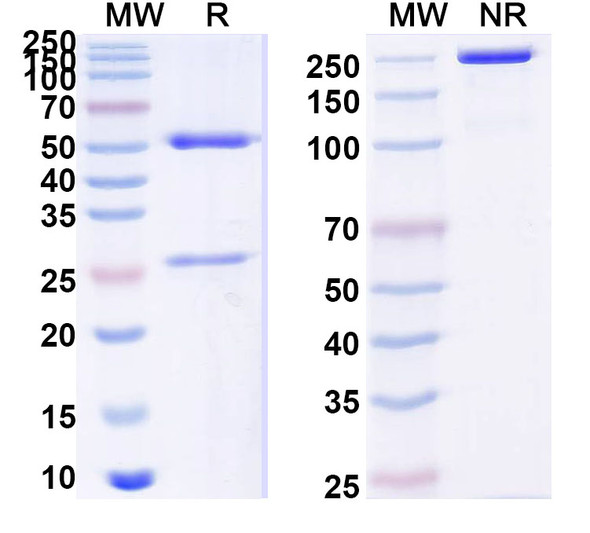 Anti-Human LCAT Recombinant Monoclonal Antibody (SAA0537) - SDS-PAGE