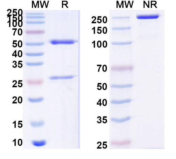 Anti-Human LCAT Recombinant Monoclonal Antibody (SAA0537) - SDS-PAGE
