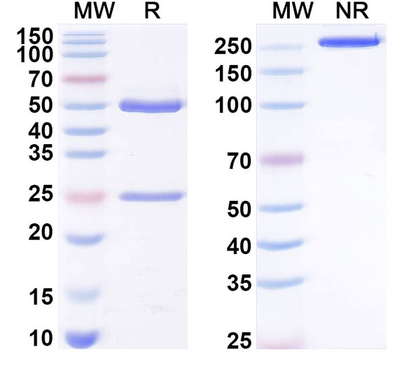 Anti-Human oxLDL Recombinant Monoclonal Antibody (SAA0553) - SDS-PAGE