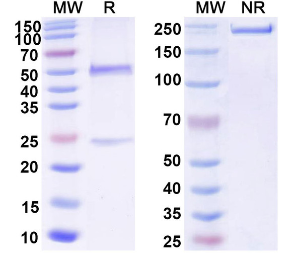 Anti-Human GFAP Recombinant Monoclonal Antibody (N206B/9R) - SDS-PAGE