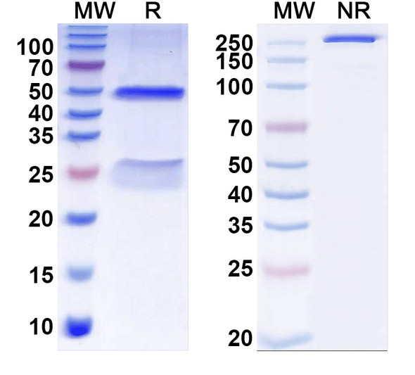Anti-LPS/Lipid A Recombinant Monoclonal Antibody (SAA0579) - SDS-PAGE